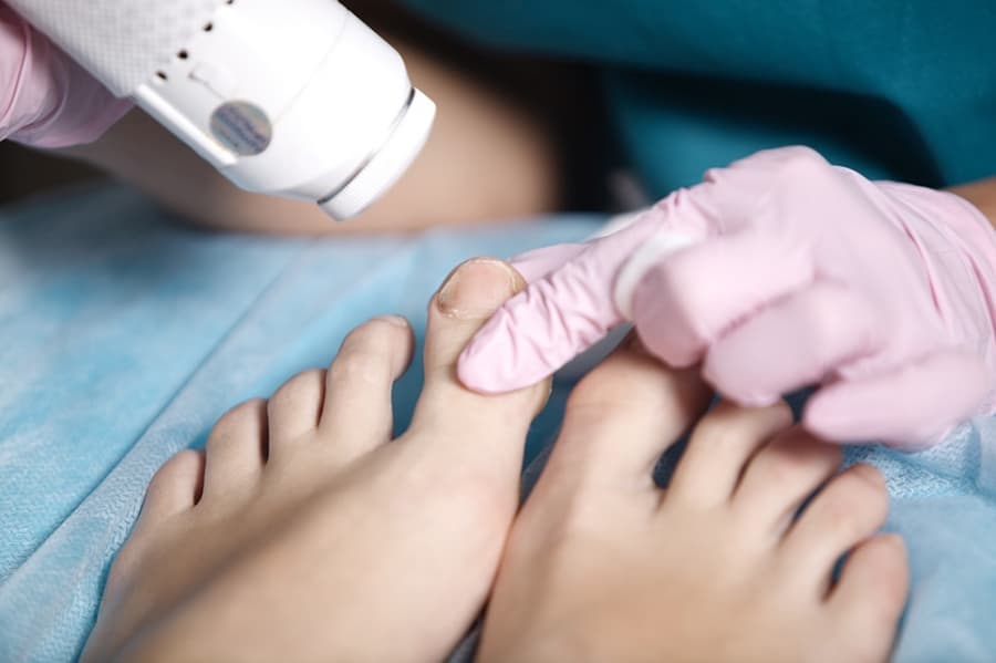 Nail Surgeries City Feet Clinic